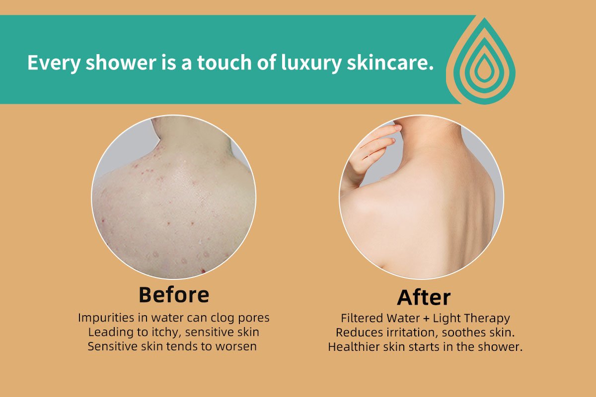 vitamin shower filter