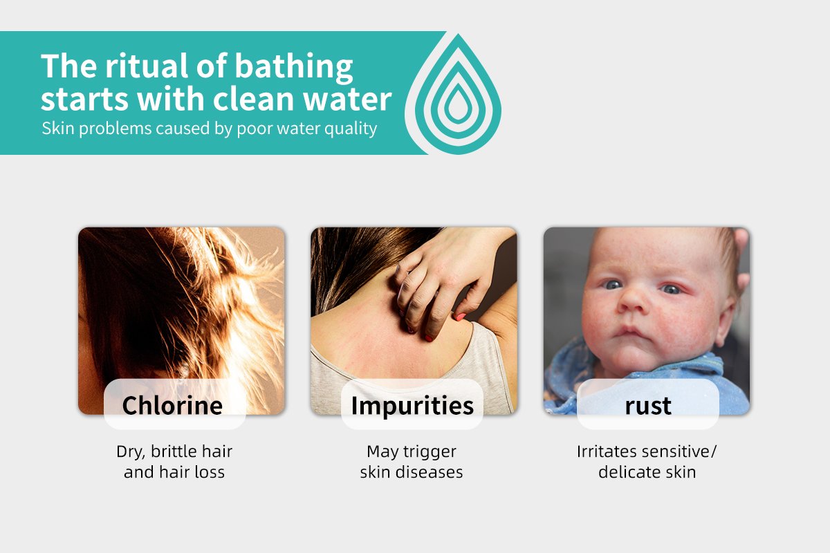 sinkcare shower filters-SH17